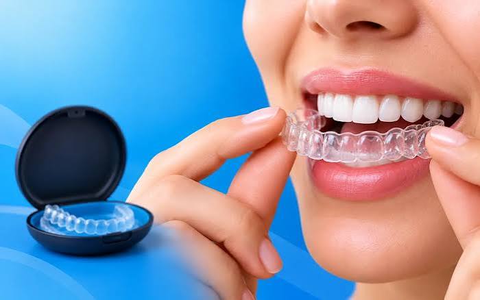 Invisalign dentist Palmdale