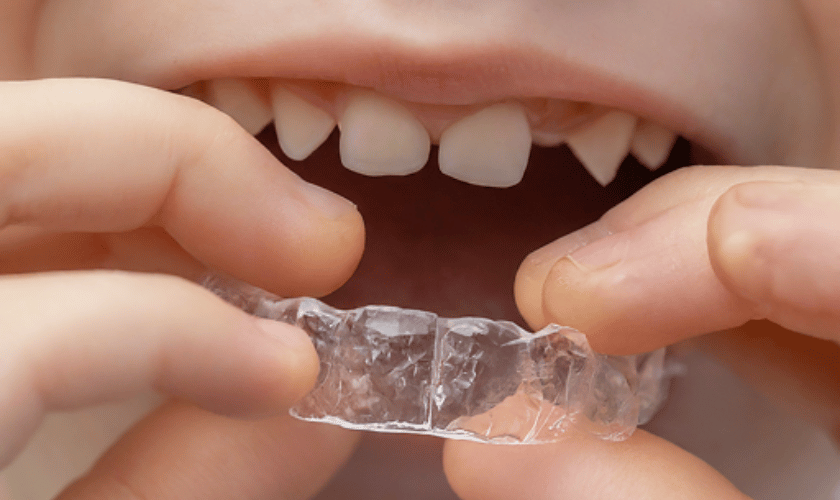 Best invisalign dentist near me