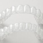 Invisalign in Palmdale